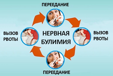 Лечение булимии в Красноперекопске
